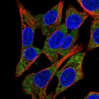 Immunofluorescent staining of human cell line Hep G2 shows localization to cytosol.