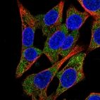 Immunofluorescent staining of human cell line Hep G2 shows localization to cytosol.