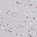 Anti-ABHD10 Antibody