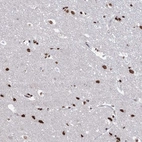 Anti-ABHD10 Antibody