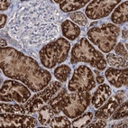 Anti-ABHD10 Antibody