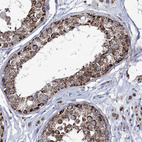 Immunohistochemical staining of human testis shows strong granular cytoplasmic positivity in seminiferous ducts.