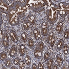 Immunohistochemical staining of human duodenum shows strong granular cytoplasmic positivity in glandular cells.