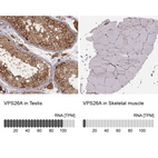 Anti-VPS26A Antibody