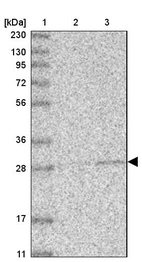 Lane 1: Marker [kDa] 230, 130, 95, 72, 56, 36, 28, 17, 11_br/_Lane 2: Human cell line RT-4_br/_Lane 3: Human cell line U-251MG sp