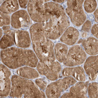 Immunohistochemical staining of human kidney shows moderate cytoplasmic positivity in cells in tubules.
