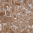 Immunohistochemical staining of human kidney shows moderate cytoplasmic positivity in cells in tubules.