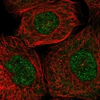 Immunofluorescent staining of human cell line A-431 shows localization to nucleoplasm.