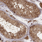 Immunohistochemical staining of human testis shows moderate to strong cytoplasmic positivity in cells in seminiferous ducts.