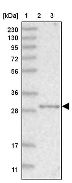 Lane 1: Marker [kDa] 230, 130, 95, 72, 56, 36, 28, 17, 11_br/_Lane 2: Human cell line RT-4_br/_Lane 3: Human plasma (IgG/HSA depleted)