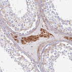 Immunohistochemical staining of human testis shows strong cytoplasmic positivity in Leydig cells.