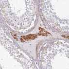 Immunohistochemical staining of human testis shows strong cytoplasmic positivity in Leydig cells.