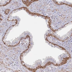 Immunohistochemical staining of human prostate shows strong cytoplasmic positivity in basal cells.