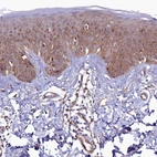 Immunohistochemical staining of human skin shows strong cytoplasmic positivity in squamous epithelial cells.