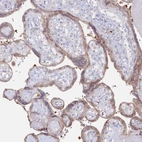 Immunohistochemical staining of human placenta shows weak cytoplasmic positivity in trophoblastic cells.