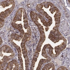 Immunohistochemical staining of human fallopian tube shows moderate to strong cytoplasmic positivity in glandular cells.