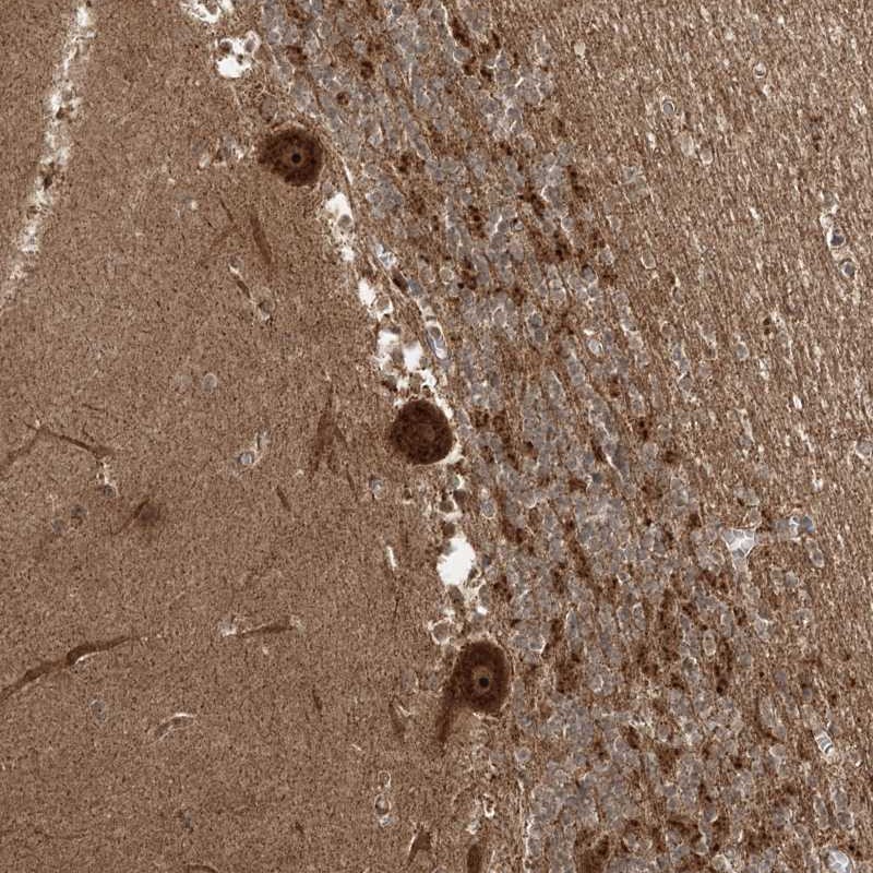 Anti-C10orf113 Antibody