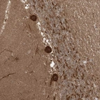 Anti-C10orf113 Antibody