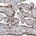 Immunohistochemical staining of human placenta shows strong nuclear positivity in trophoblastic cells.