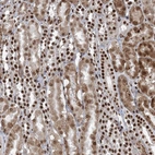 Immunohistochemical staining of human kidney shows strong nuclear positivity in cells in tubules.
