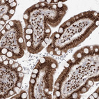 Immunohistochemical staining of human small intestine shows strong nuclear positivity in glandular cells.