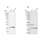 Western blot analysis using Anti-CGGBP1 antibody HPA037017 (A) shows similar pattern to independent antibody HPA035568 (B).