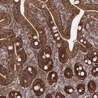 Immunohistochemical staining of human duodenum shows moderate to strong cytoplasmic positivity in glandular cells.