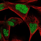 Immunofluorescent staining of human cell line RH-30 shows localization to nucleus.