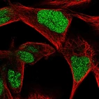 Immunofluorescent staining of human cell line RH-30 shows localization to nucleus.