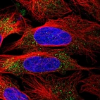 Immunofluorescent staining of human cell line U-2 OS shows localization to cytosol.