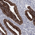 Anti-YTHDC2 Antibody