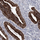 Anti-YTHDC2 Antibody
