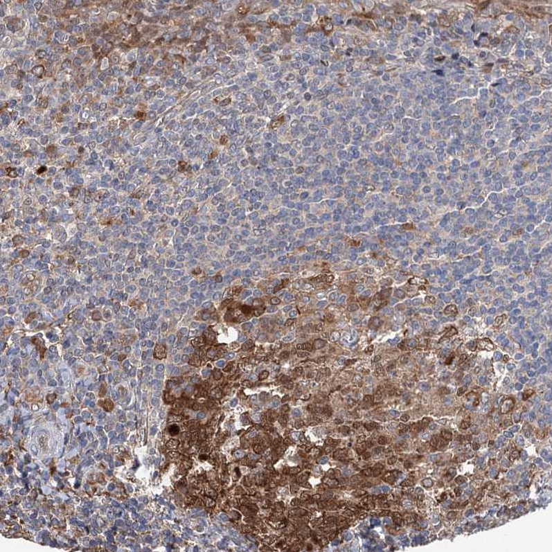 Anti-NCAPD2 Antibody