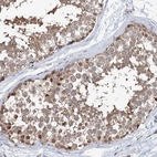Immunohistochemical staining of human testis shows moderate cytoplasmic positivity in cells in seminiferous ducts.