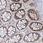 Immunohistochemical staining of human rectum shows moderate cytoplasmic positivity in glandular cells.