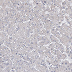 Immunohistochemical staining of human liver shows no positivity in hepatocytes as expected.