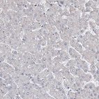 Immunohistochemical staining of human liver shows no positivity in hepatocytes as expected.