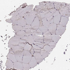 Immunohistochemical staining of human skeletal muscle shows no positivity in striated muscle fibers as expected.