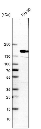 Western blot analysis in human cell line RH-30.