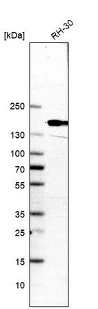 Western blot analysis in human cell line RH-30.