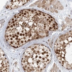 Anti-R3HCC1L Antibody