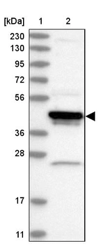 Lane 1: Marker [kDa] 230, 130, 95, 72, 56, 36, 28, 17, 11_br/_Lane 2: Human cell line RT-4