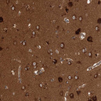 Immunohistochemical staining of human cerebral cortex shows strong positivity in neuropil.