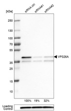 Western blot analysis in U-251MG cells transfected with control siRNA, target specific siRNA probe #1 and #2, using Anti-VPS26A antibody. Remaining relative intensity is presented. Loading control: Anti-PPIB.