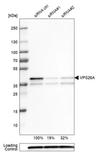 Western blot analysis in U-251MG cells transfected with control siRNA, target specific siRNA probe #1 and #2, using Anti-VPS26A antibody. Remaining relative intensity is presented. Loading control: Anti-PPIB.