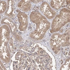 Immunohistochemical staining of human kidney shows weak cytoplasmic positivity in cells in tubules.