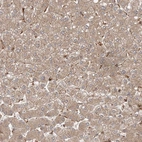 Immunohistochemical staining of human liver shows weak positivity in hepatocytes as expected.