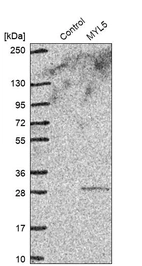 Western blot analysis in control (vector only transfected HEK293T lysate) and MYL5 over-expression lysate (Co-expressed with a C-terminal myc-DDK tag (~3.1 kDa) in mammalian HEK293T cells, LY419312).