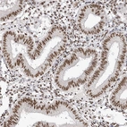 Immunohistochemical staining of human endometrium shows moderate nuclear positivity in glandular cells.