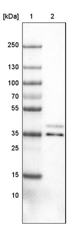 Lane 1: Marker [kDa]_br/_Lane 2: Human cell line U-251 MG
